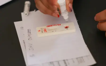 Ação no DF oferece testagem rápida e informação sobre HIV/Aids