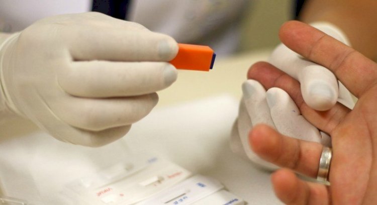 Hospital das Clínicas faz mutirão de teste rápido de HIV no terminal de ônibus de Pinheiros (SP)