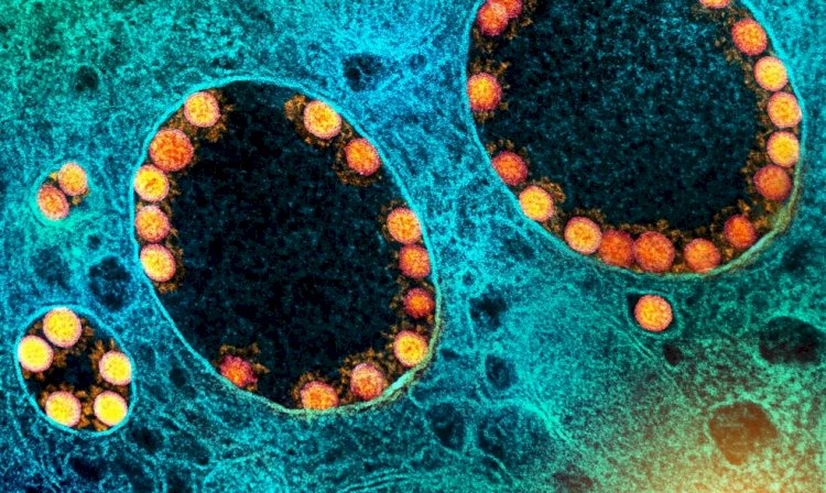 Reinfecção por coronavírus mais do que dobra risco de morte, diz estudo nos EUA com grupo na faixa dos 60 anos